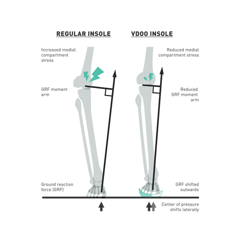 Illustration of Regular Insole compare with VDOO Insole. Regular insole increases medial compartment stress while VDOO insole reduces it.